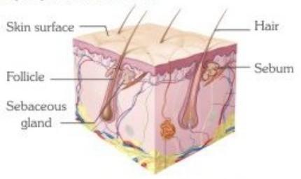 Published on: 7 Nov 2010 Acne: Overview Introduction Acne, more commonly called as pimples: is the most common skin disorder seen in adolescence.