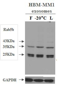 Figure 2: Comparison of exosomal markers on fresh and lyophilized exosomes. FACS profiles of exosomes that were purified by differential centrifugation from human colon cancer cell line supernatant.