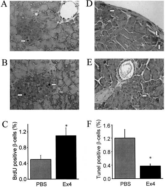 Q. Wang et al.: Glucagon-like peptide-1 treatment delays the onset 1269 Fig. 6A F. Effect of Ex4 on beta-cell replication and apoptosis. A B Pancreatic sections were stained for insulin and BrdU.