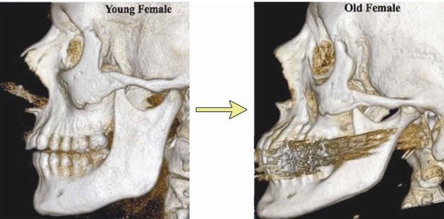 R. Ghaffari, A. Hosseinzade, H. Zarabi, M. Kazemi Introduction Skeletal bone is scaffold for the soft tissue.