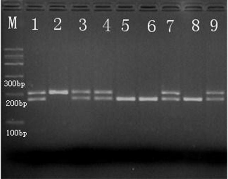CYP19 gene polymorphisms and breast cancer 8477 Restriction enzyme SduI (Bsp1286) digestion of CYP19 The arginine allele (CC) was identified by the presence of 172 and 30 bp fragments.
