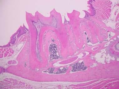 () Histologicl findings of gingivl tissues of -dministered nd shm-dministered mice. Sections of the periodontium round the disto-uccl root of the first molr were H-E stined.