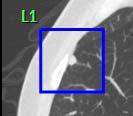 5. Click on the nodule to mark it. A blue bounding box appears around the nodule.