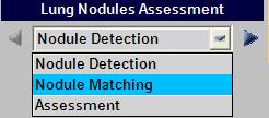 Follow the steps below to perform nodule matching on two studies: Nodule Matching Process: 1.