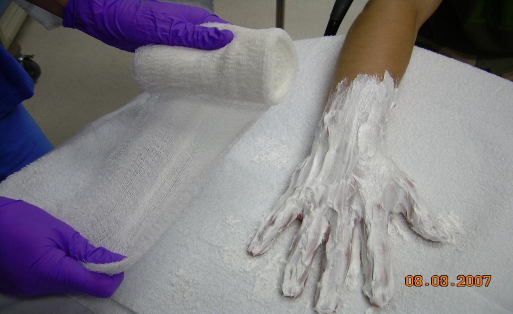 Hold gauze with the bulk of the roll in the dominant hand, the first layer pulled from