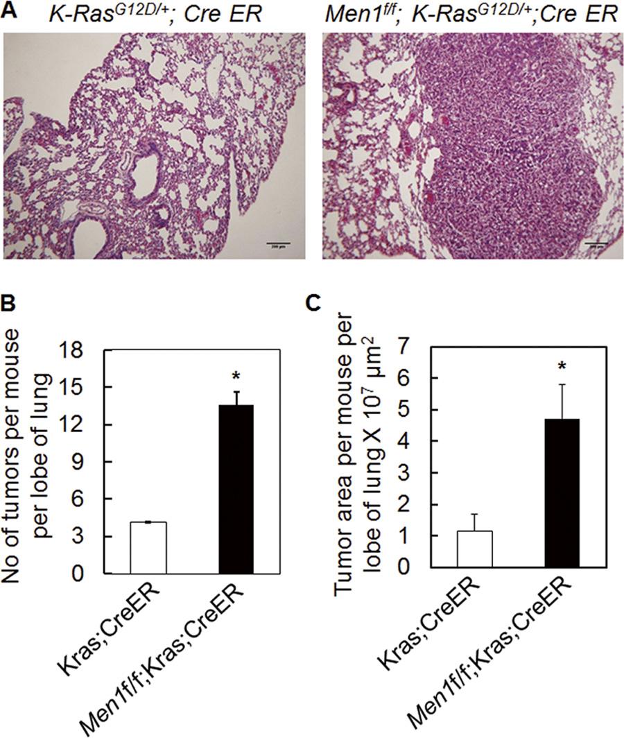 FIGURE 6. Menin excision promotes the development of K-Ras-induced lung cancer.