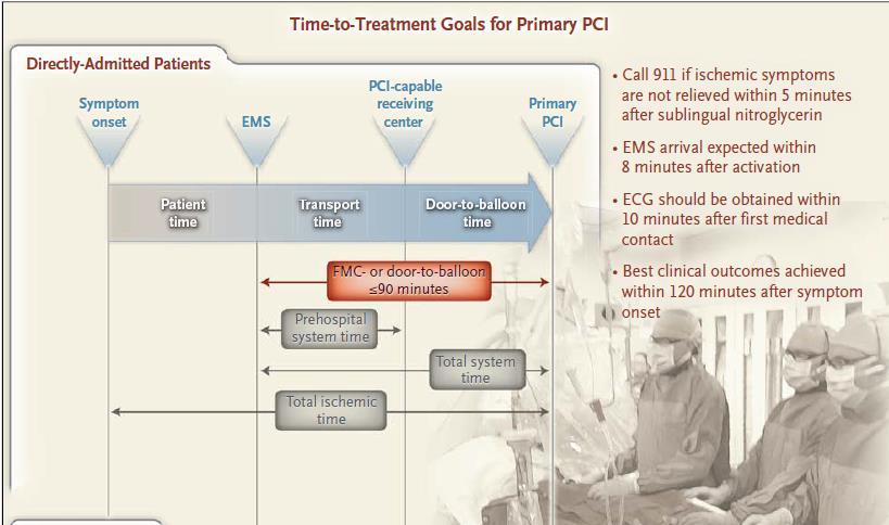 Time To Treatment Goals for Primary PCI 2013 ACCF/AHA guidelines for the management of ST-elevation myocardial