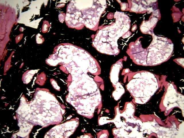 Peri-osteocytic Osteoid No label