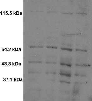 25 mmol/kg SAME (lane 2), 300 mg/kg APAP (lane 3), and SAMe APAP (lane 4) as described under Materials and Methods. Western blots were performed using an OxyBlot kit to detect protein carbonyls.