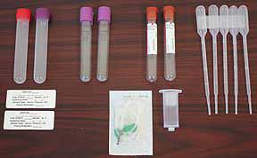 SUPPLIES FOR BIOMARKER SAMPLES FROM ATRI: 1. 13-mL polypropylene transfer tubes with colored screw caps (red screw-capped for transfer of serum; lavender screw-capped for transfer of plasma) 2.