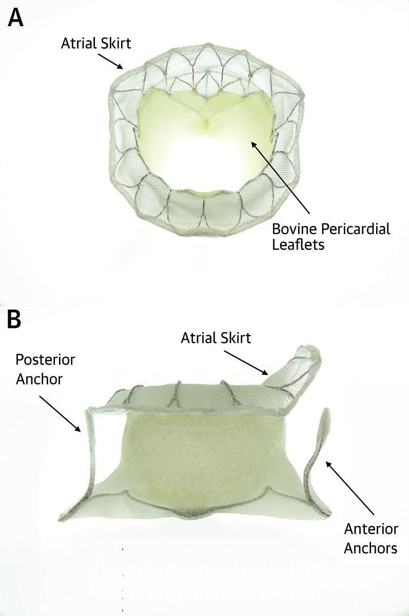 Tiara A novel transcatheter Mitral Valve replacement Fits anatomical shape of native valve Does not obstruct LVOT and preserves LV function Quick and repeatable