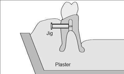 length of attachment needed. After try-in and a passive bar fit verified, seat the wax denture over the bar.