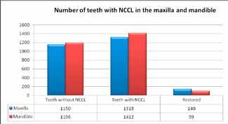 mandible (Chart 4), although more restored teeth were recorded in the maxilla. Kan at al. (16) Chart 1. Presence of NNCL with reposndants Chart 4.