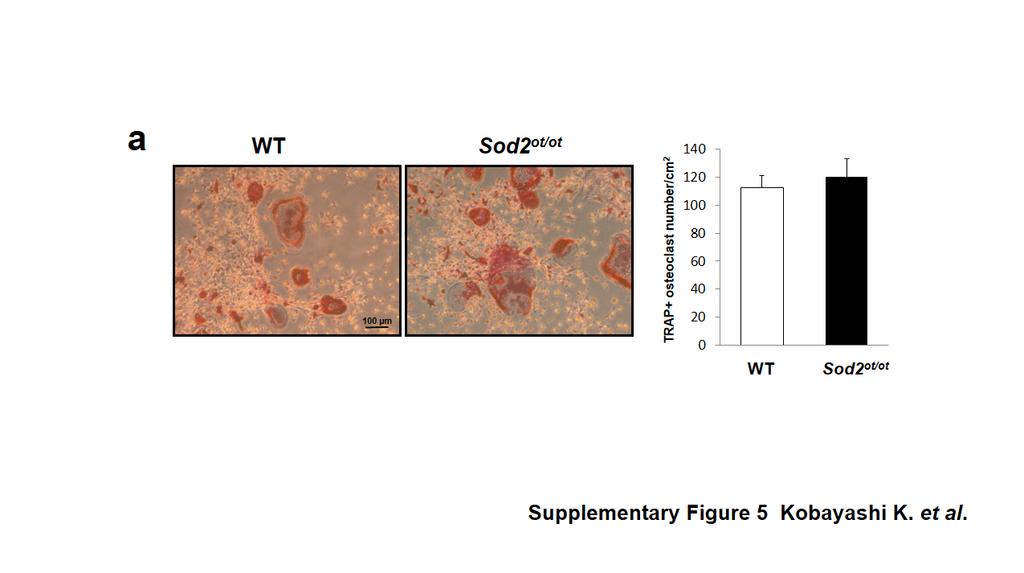 Supplementary Figure S5. Normal osteoclast differentiation from Sod2 ot/ot bone marrow.