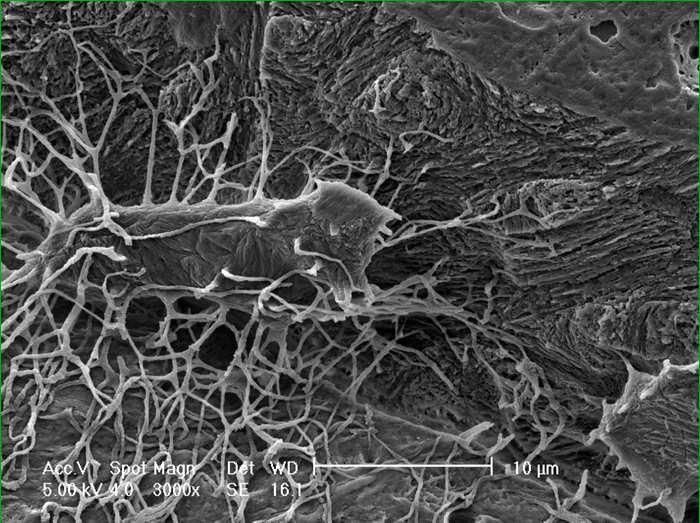 7/24/214 Osteocyte Lcuno-Cnliculr System Contct with Cells on the Bone Surfce Excess Increses