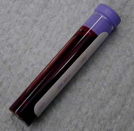 Cytogenomics Testing Constitutional Peripheral Blood, Skin punch,