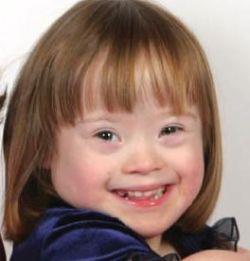 Down s Syndrome Caused by