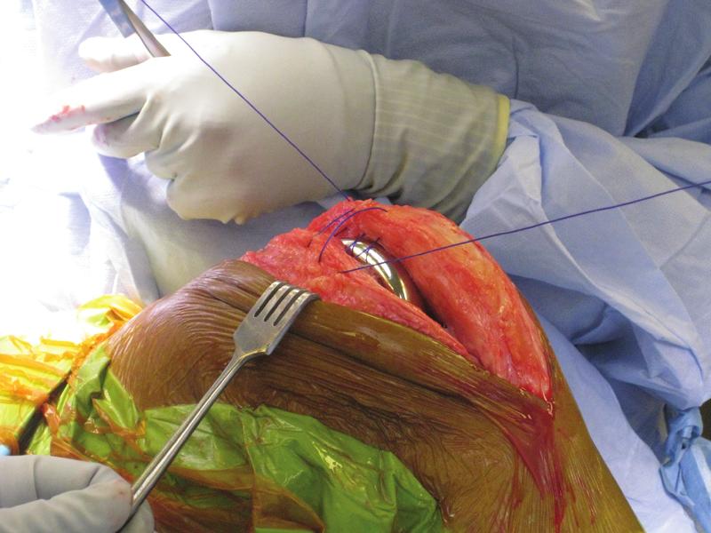 costly aspects of surgical procedures.