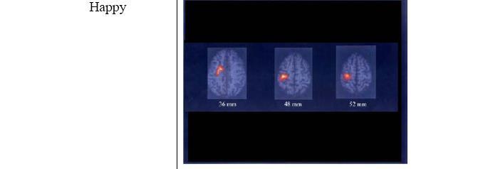 The Brain Responses to Two Pictures (MRI Scan)