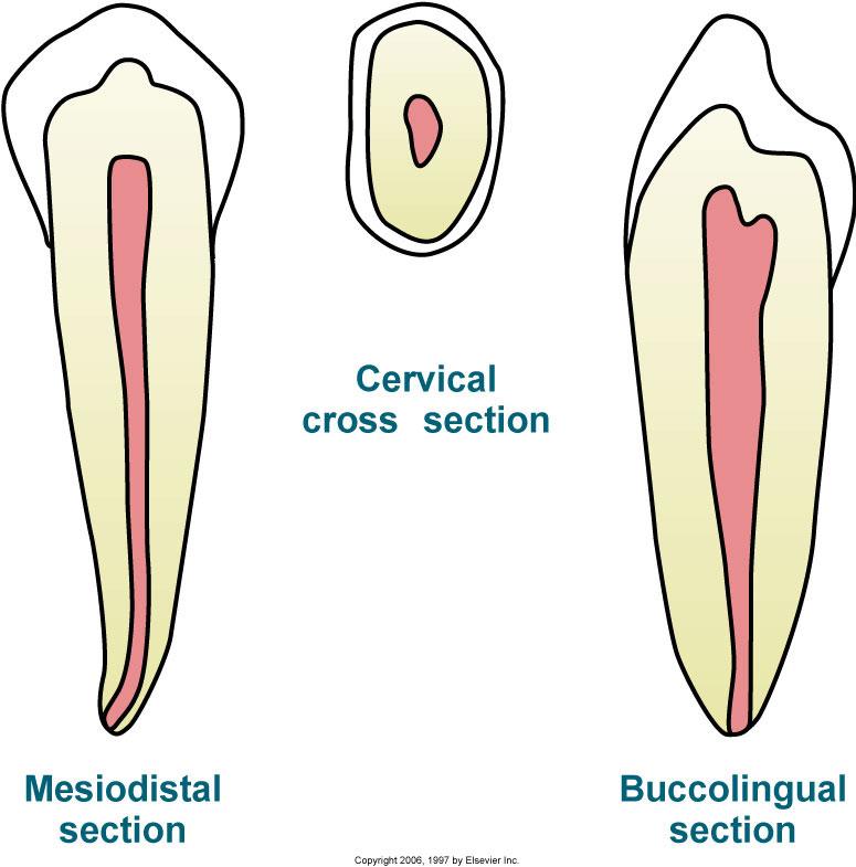 Mandibular First Premolars Root & Pulp Cavity usingle-rooted form most common, although buccallingual two-rooted 1st