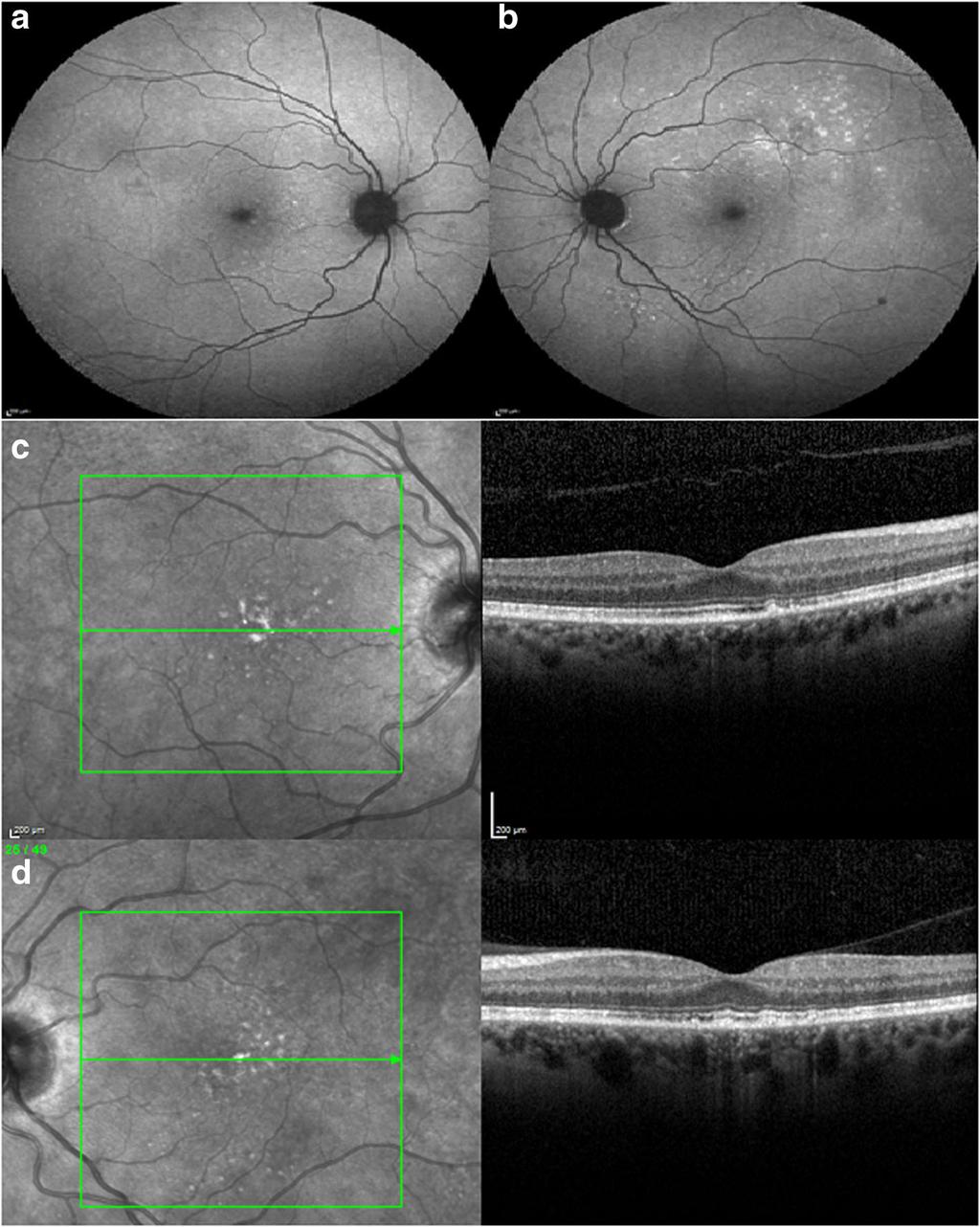 Tan et al. BMC Ophthalmology 2018, 18(Suppl 1):223 Page 51 of 58 (See figure on previous page.) Fig.