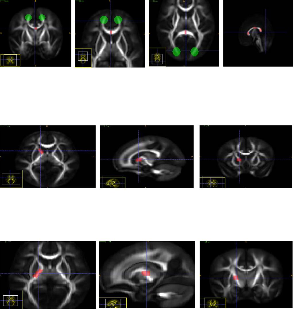 X. Geng et al. / NeuroImage 61 (2012) 542 557 553 Table A1 Descriptions of manually defined regions of interest along with snapshots.
