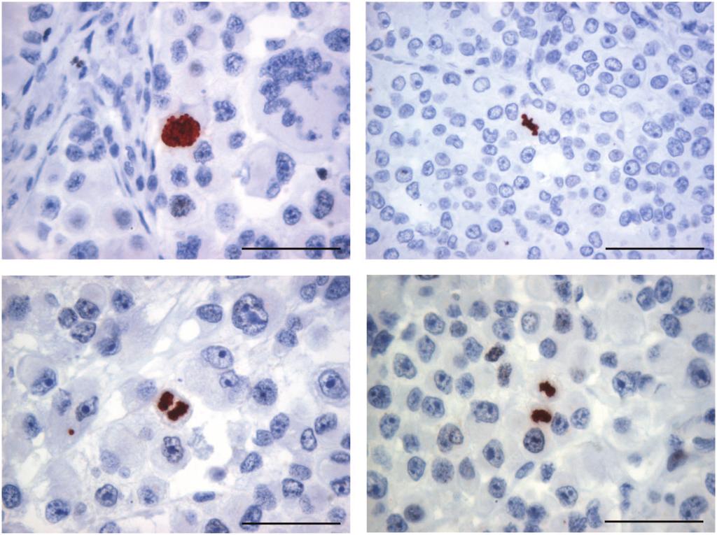 Figure 3. Phosphohistone H3 staining in different mitotic phases. PHH3- stained mitotic figures in (a) prophase, (b) metaphase, (c) anaphase, and (d) telophase. Bar ¼ 50 mm.