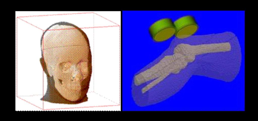 Need of human models for specific body parts CT scan model of a