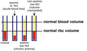 vice versa - Patients with acute blood loss, such as traumatic hemorrhage in a car accident, loses equal amounts of plasma and packed RBCs, hence, the patient will have normal CBC at the time of