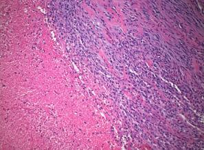 uterine tumor. (a) (b) (c) (d) (e) (f) (g) (h) Figure 2: Histology.