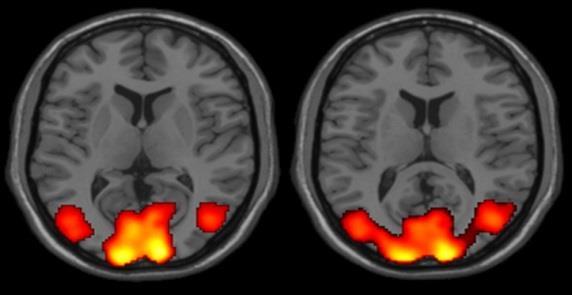 Aging Using f-mri to record brain responses to an auditory working memory task in young and older healthy individuals, alternatively maintained in darkness or exposed to blue light: the older brain