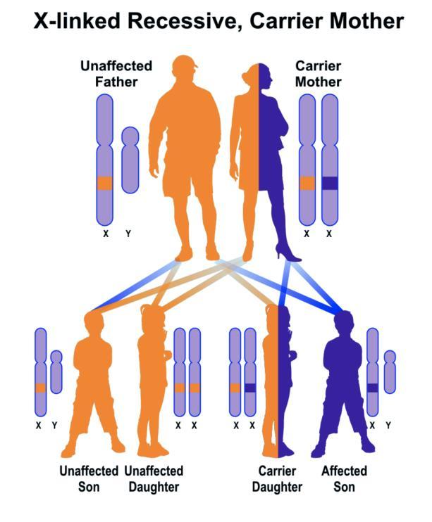 DMD is X linked recessive: mostly males are affected and