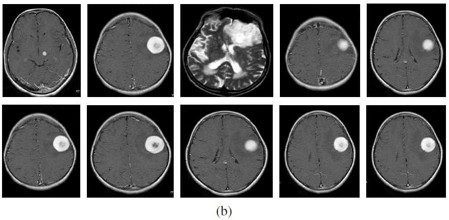 The training dataset is used to segment the brain tumor images and the testing dataset is used to analyze the performance of the proposed technique.