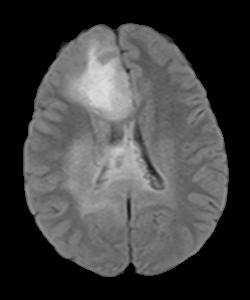 image of non-tumor images 7.