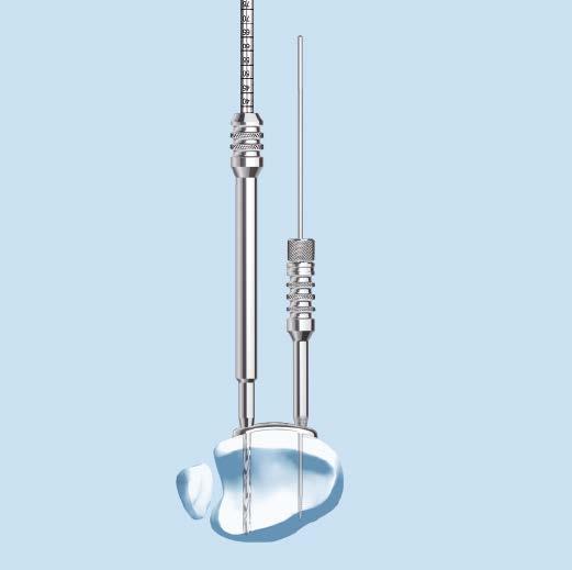 Insert Screws Determine the combination of screws to be used for fixation.