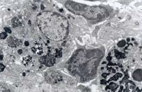 Tissues Neutrophil
