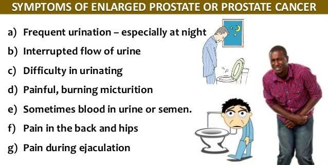 Erectile dysfunction What are the causes of Prostate Cancer? It's not clear what causes prostate cancer. Doctors know that prostate cancer begins when some cells in your prostate become abnormal.