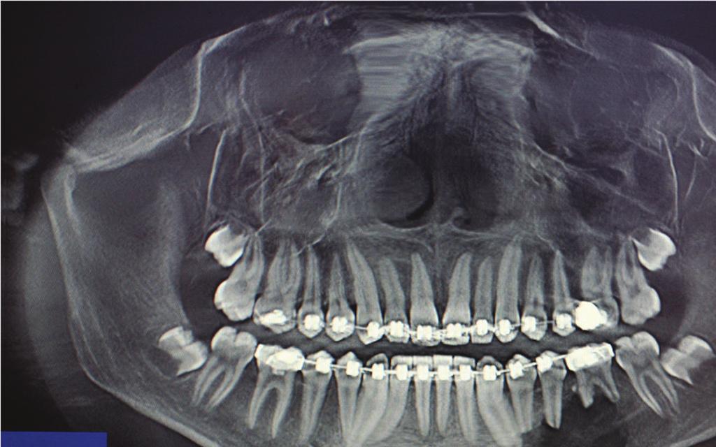 5 Oral Labial/buccal Plastic