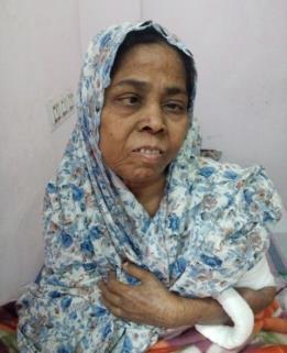 Nasreen Sultana, 39yrs - suffering from Renal Failure and is on dialysis and