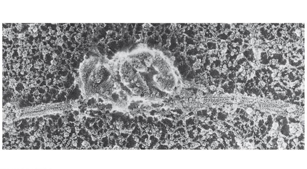 Figure 6.21a Microtubule Vesicles 0.