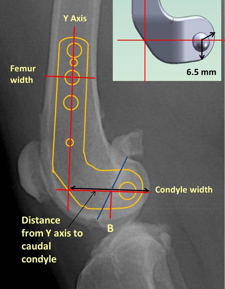 determined by the size and shape of the medial femoral condyle.