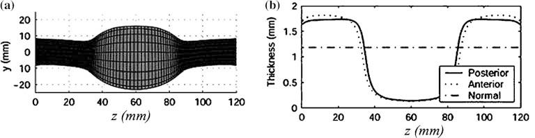 The remodelling parameters are fixed (a=1, b =14) and the same degradation of elastin (Fig.