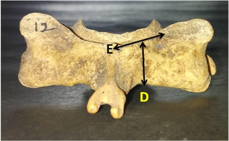Fig. 1: Showing the height (A) of typical cervical vertebral body. Fig. 5: Showing the length of spinous (H) process of typical cervical vertebra. Fig. 2: Showing the transverse diameter (B) and anteroposterior diameter (C) of typical cervical vertebral body.