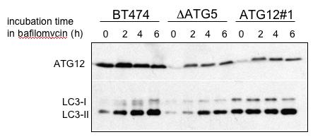 growth assessed over 10 days. Fig. 10. Recovery of ATG12 in BT474 cells previously repressed for this protein.
