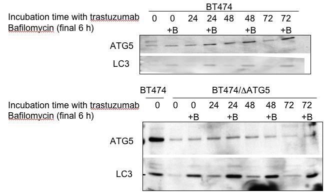 SUPPORTING DATA Fig. 1. Impact of trastuzumab and bafilomycin on induction of autophagy in BT474 cells.