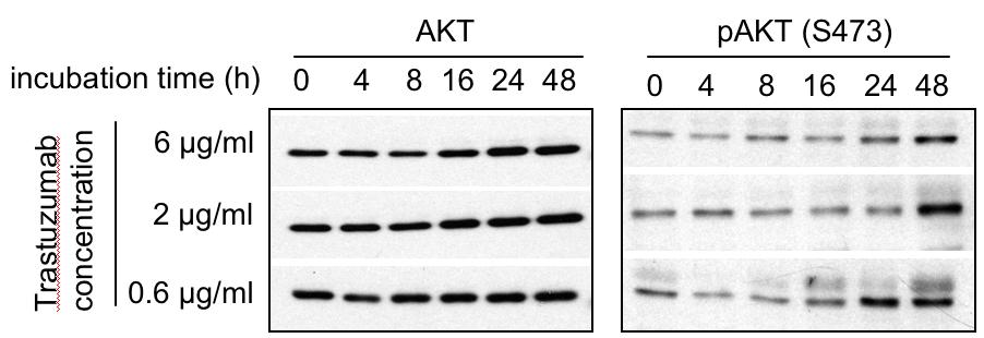 3 and threoinine 308 was assessed by western blotting. Fig. 4. Lack of impact of serum concentration on trastuzumab inhibition of phospho-akt.