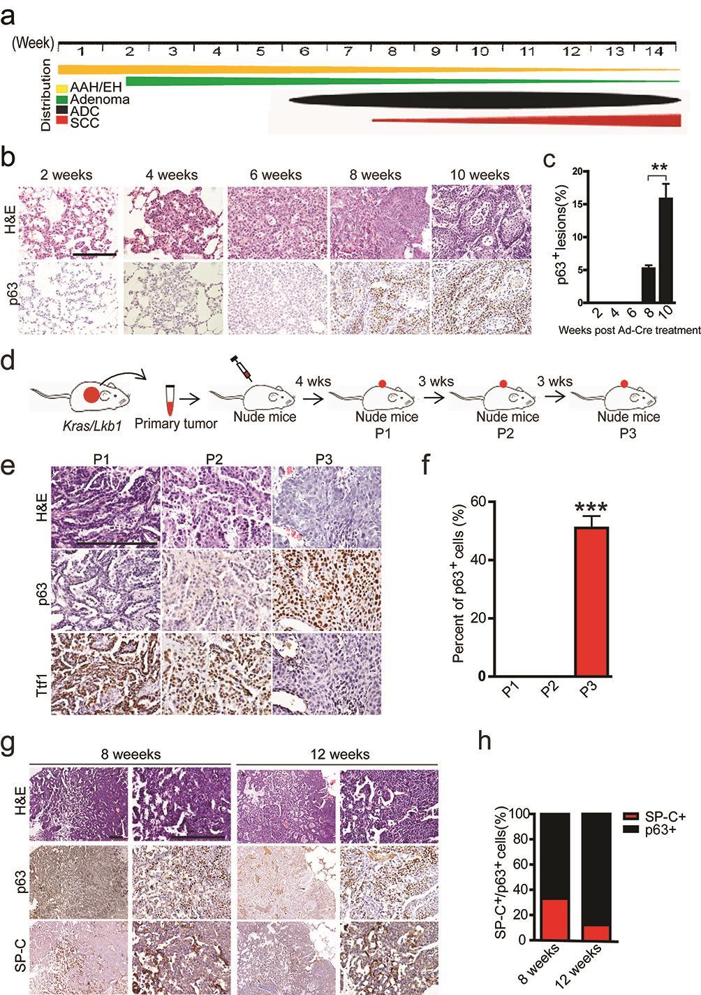 Supplementary Figure 1. Lkb1-deficient lung ADC progressively transdifferentiates into SCC.