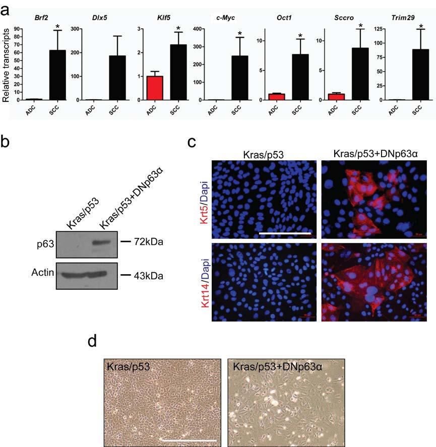 Supplementary Figure 8. Activation of DNp63α partially promotes ADC to SCC transdifferentiation.
