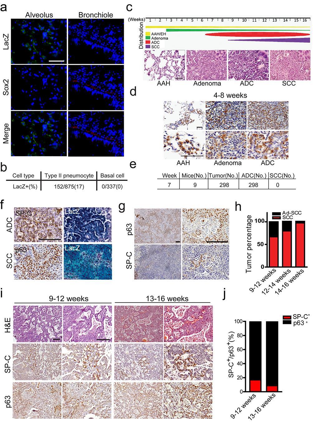 Supplementary Figure 2. Type II pneumocyte lineage-derived lung ADC with Lkb1 deficiency transdifferentiates into SCC.