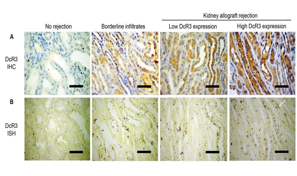 Supplementary Figure S4. In situ hybridization (ISH) studies and immunohistochemical (IHC) staining for different severity of kidney allografts.